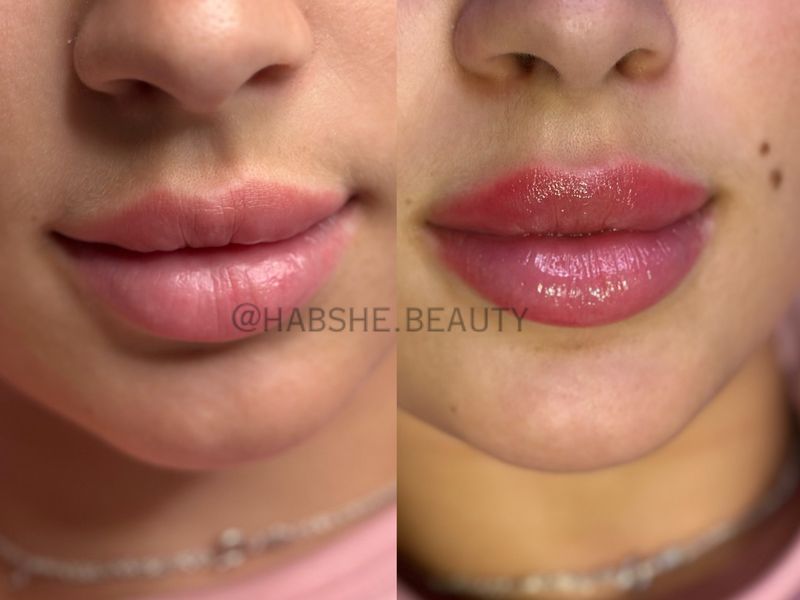 Vorher-Nachher: Lip Glow, mehr Farbe und Feuchtigkeit
